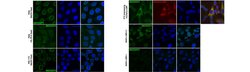 Lamin B Receptor (LBR), Mouse anti-Human, Mouse, Clone: BB2SS3F3, Millipore